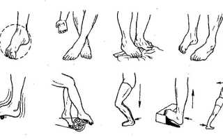 Что делать после снятия гипса с ноги