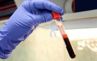 Общий анализ крови с лейкоформулой: расшифровка у взрослых