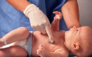 Эффективность глюкозы при желтухе у новорожденных