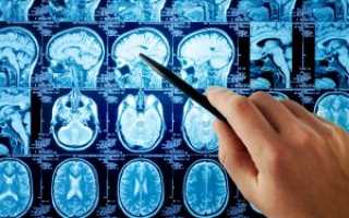 Как делают МРТ головного мозга с контрастированием?