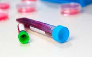Общий анализ крови – тромбоциты: диагностика и расшифровка