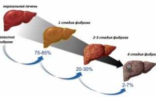 Классификация цирроза печени
