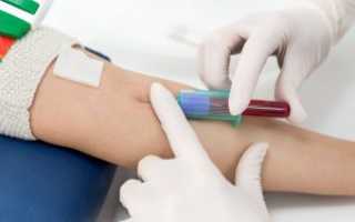 О чем может рассказать иммунологическое исследование крови?